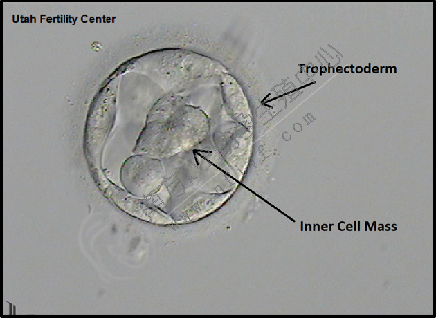 胚胎的分类胚胎