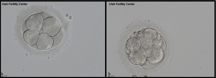 胚胎的分类胚胎