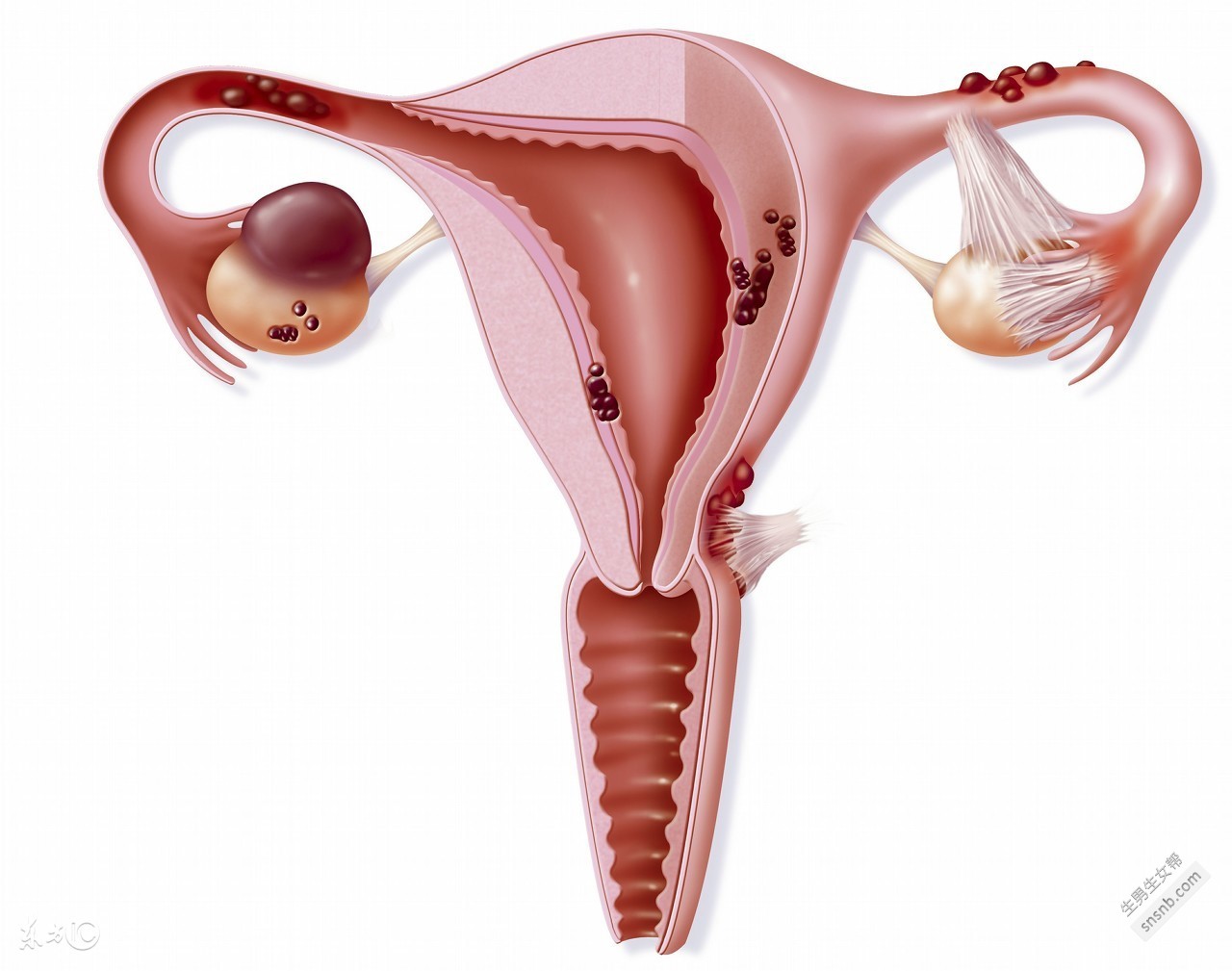 输卵管堵塞的症状做几次通液比较合适？